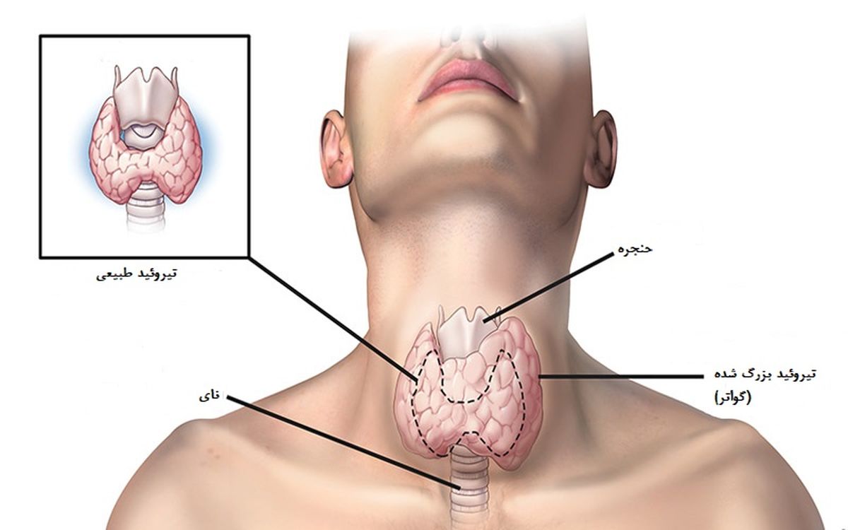 آزمایش تیروئید در منزل با آزمایش آنلاین