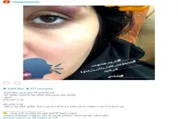 بازیگر زن معروف مورد حمله افراد ناشناس قرار گرفت!/عکس