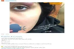 بازیگر زن معروف مورد حمله افراد ناشناس قرار گرفت!/عکس