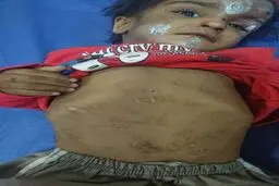 کودک آزاری در رفسنجان توسط پدر و مادر!+ عکس