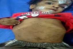 کودک آزاری در رفسنجان توسط پدر و مادر!+ عکس
