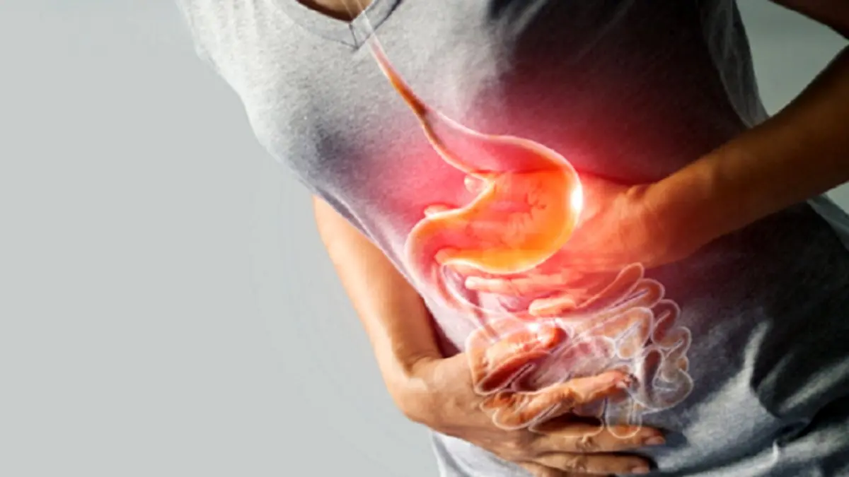 سرطان‌ معده چیست؟ + علائم و درمان سرطان معده