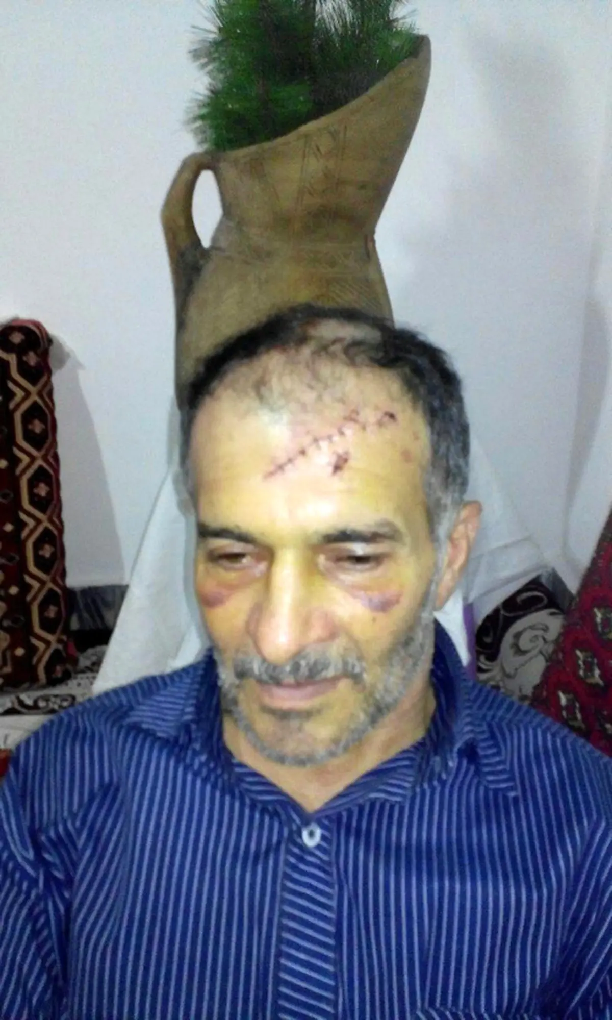 حمله پلنگ خشمگین به دامدار آملی+ عکس