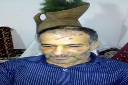 حمله پلنگ خشمگین به دامدار آملی+ عکس