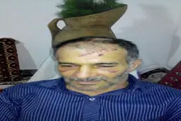 حمله پلنگ خشمگین به دامدار آملی+ عکس