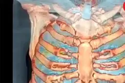 ساخت بهترین داروی کرونا توسط یک ایرانی در سوئد / دکتر علی میرعظیمی کیست؟ + فیلم