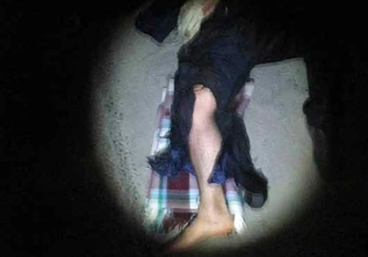 پای موتورسوار قطع شد + عکس