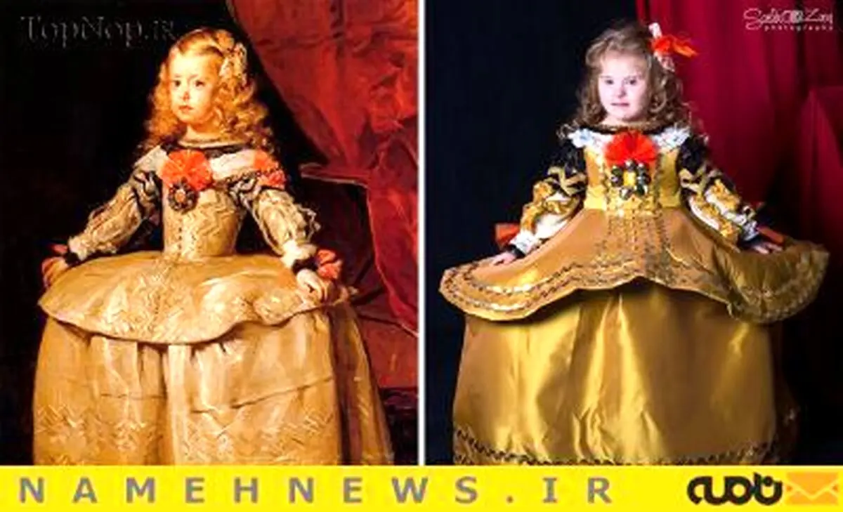 کودکان سندروم داوون مدل عکاسی شدند+تصاویر