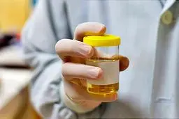 7 نشانه عفونت ادراری که همه باید بدانند