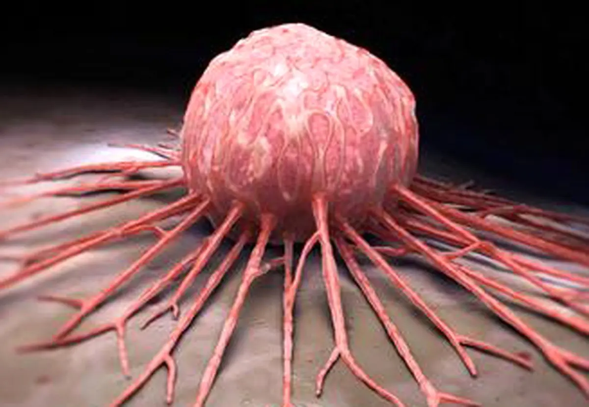 با این رژیم غذایی از سرطان سینه جلوگیری کنید!