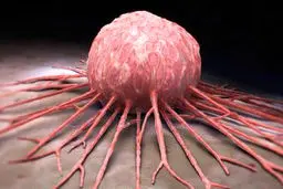 با این رژیم غذایی از سرطان سینه جلوگیری کنید!