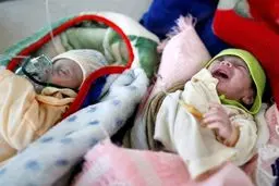 تصاویر دلخراش از کودکان یمنی گرفتار در «بزرگترین بحران قحطی جهان»