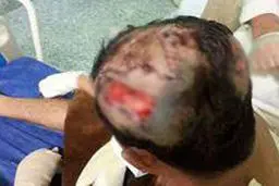 نجات مرد جوان پس از حمله گله گرگ ها+عکس