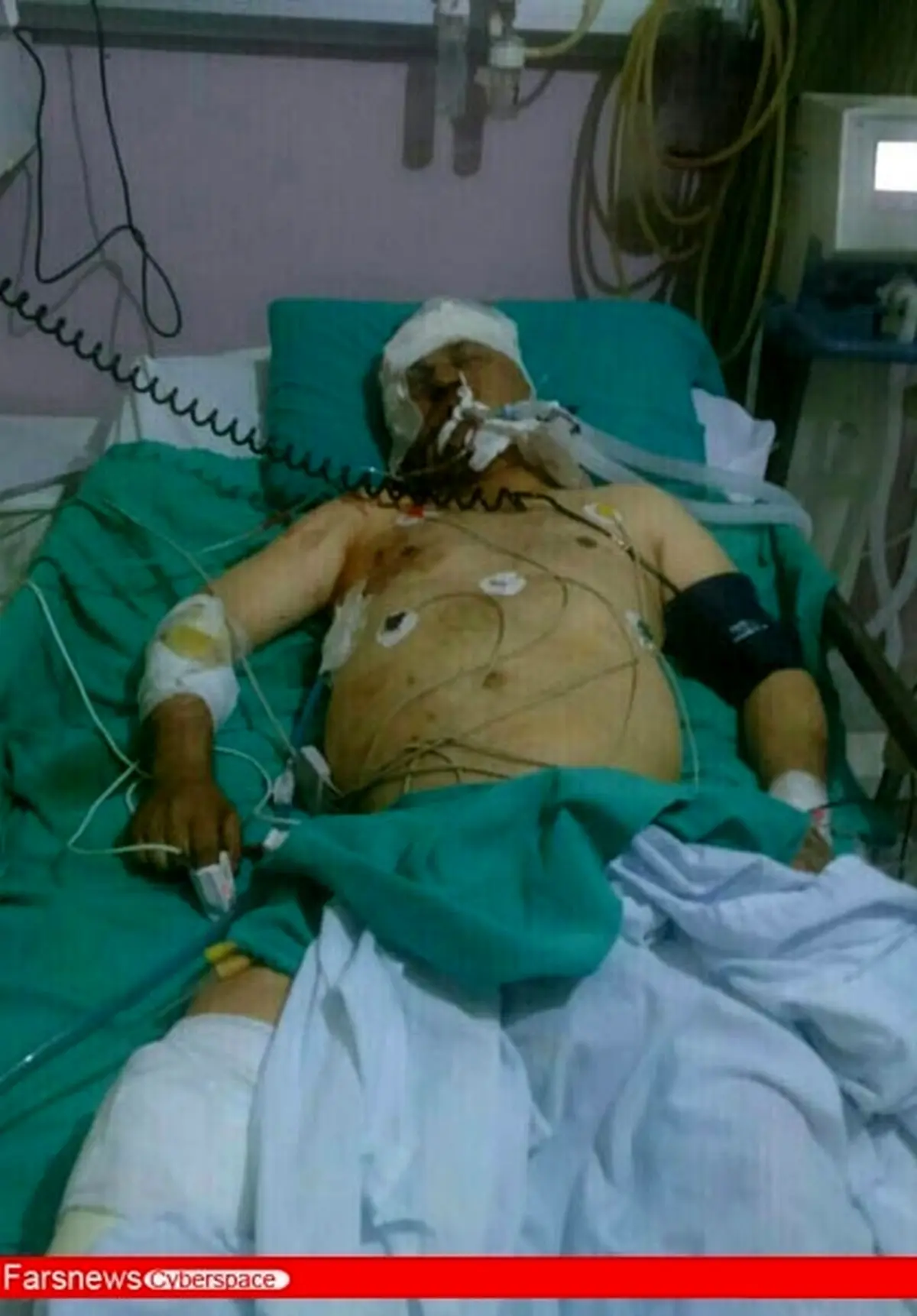 اولین تصویر ازخبرنگار مجروح ایرانی درسوریه/عکس