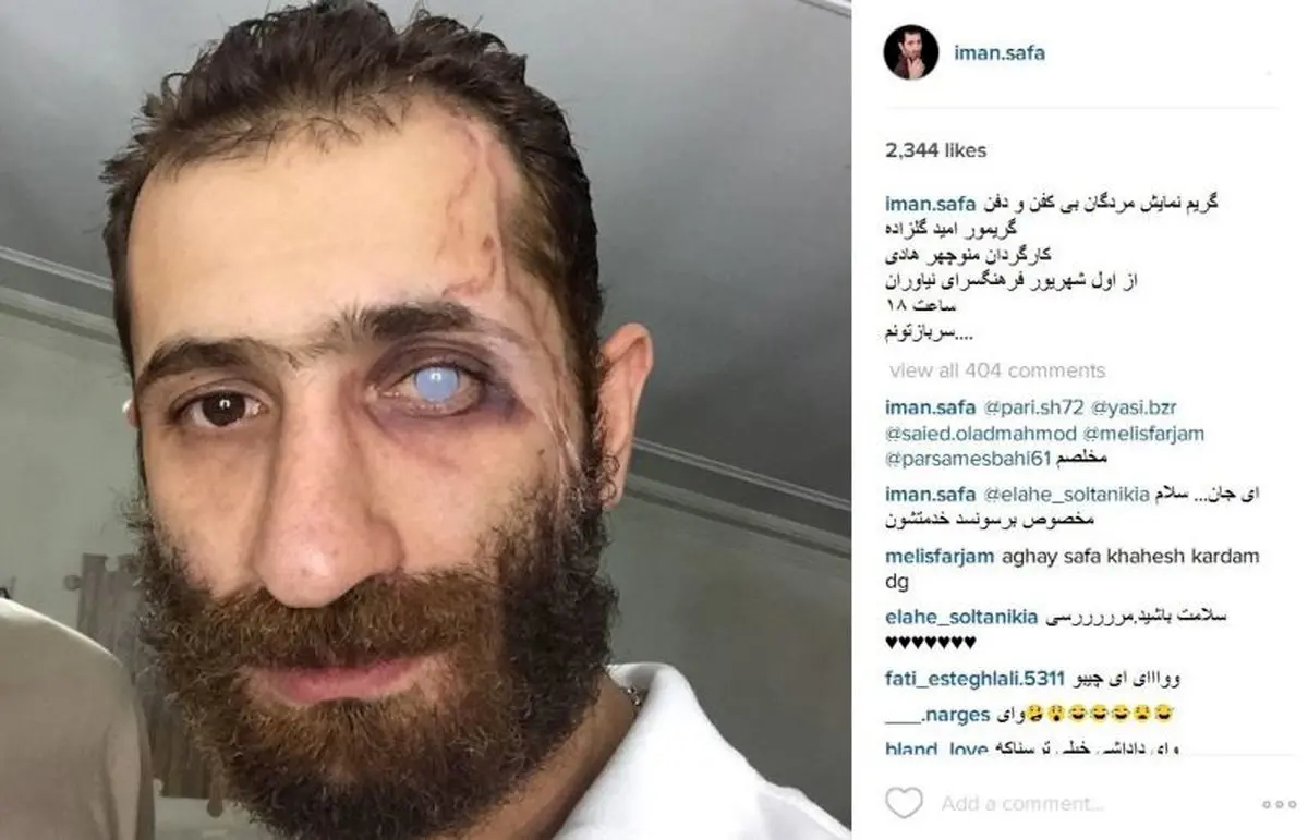 گریم وحشتناک آقای بازیگر! /عکس