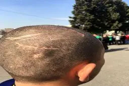 ماجرای عجیب شروری که ساختمان ۸ واحدی را در تهران به آتش کشید + تصاویر