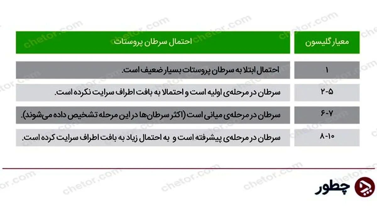 علائم سرطان پروستات؛ چه کسانی در معرض ابتلا به این سرطان هستند؟