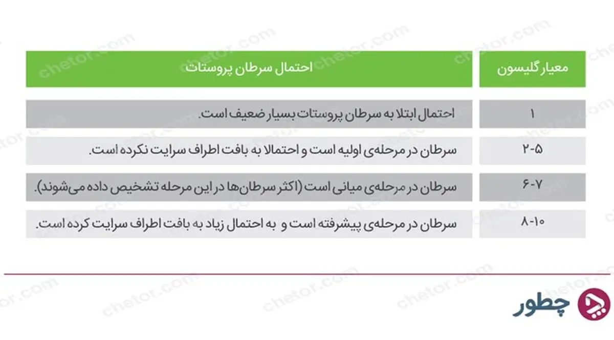 علائم سرطان پروستات؛ چه کسانی در معرض ابتلا به این سرطان هستند؟