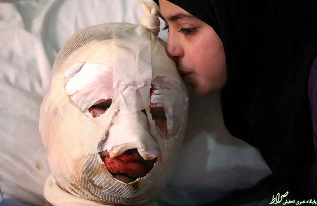 عکس/ بوسه گریان دختر بر صورت پدر