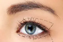 روش های درمان افتادگی پلک