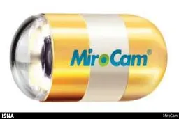 یک قرص جایگزین آندوسکوپی شد + عکس