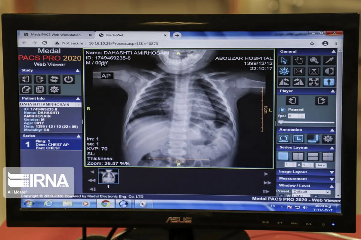 بخش کودکان مبتلا به کرونا بیمارستان ابوذر اهواز+عکس‌ها