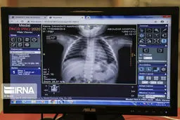 بخش کودکان مبتلا به کرونا بیمارستان ابوذر اهواز+عکس‌ها