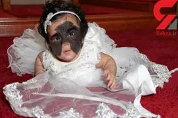 یک دختر با چهره ای عجیب در آمریکا به دنیا آمد+ عکس