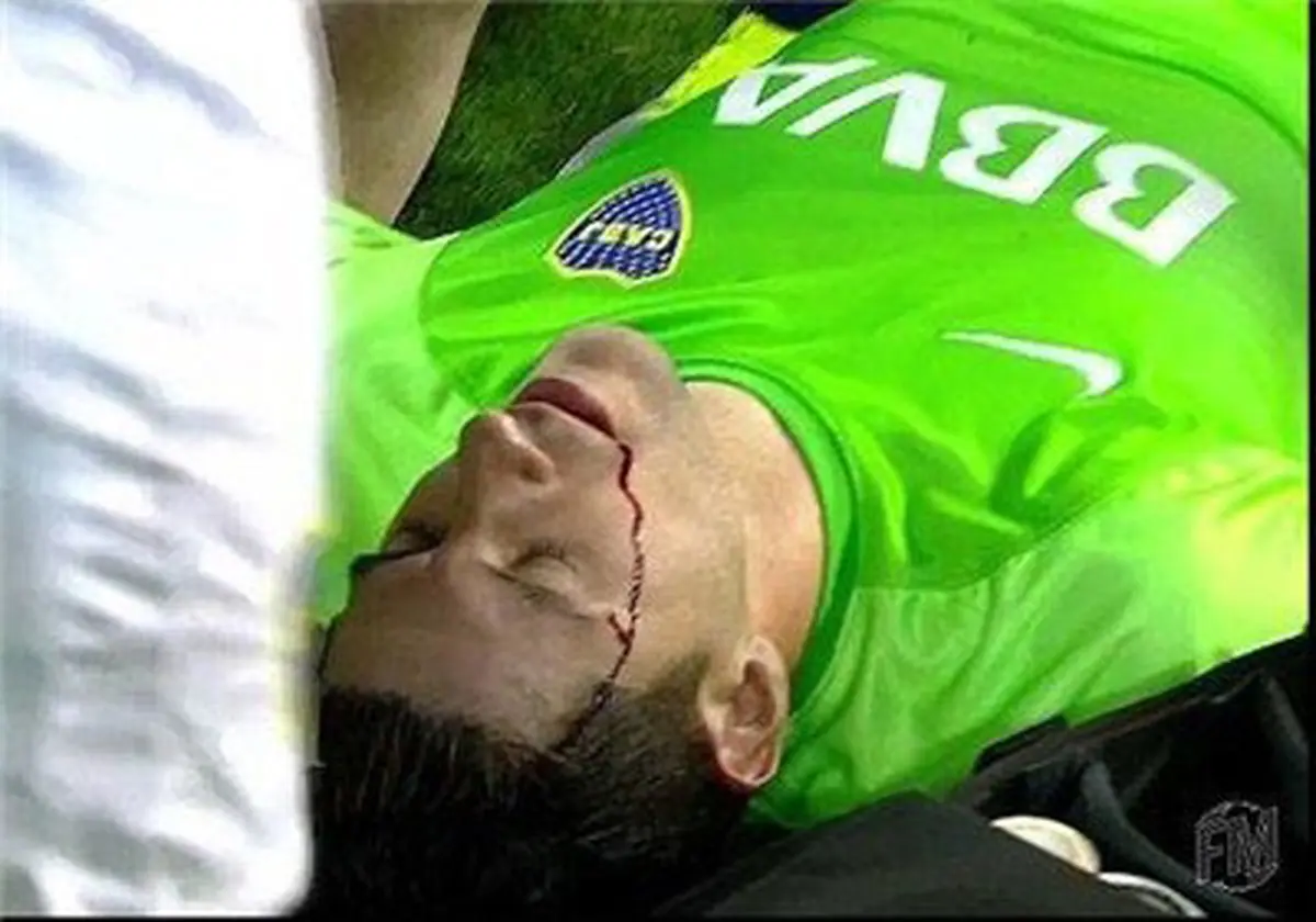 پرتاب سنگ دروازه بان را به خون کشید+ عکس