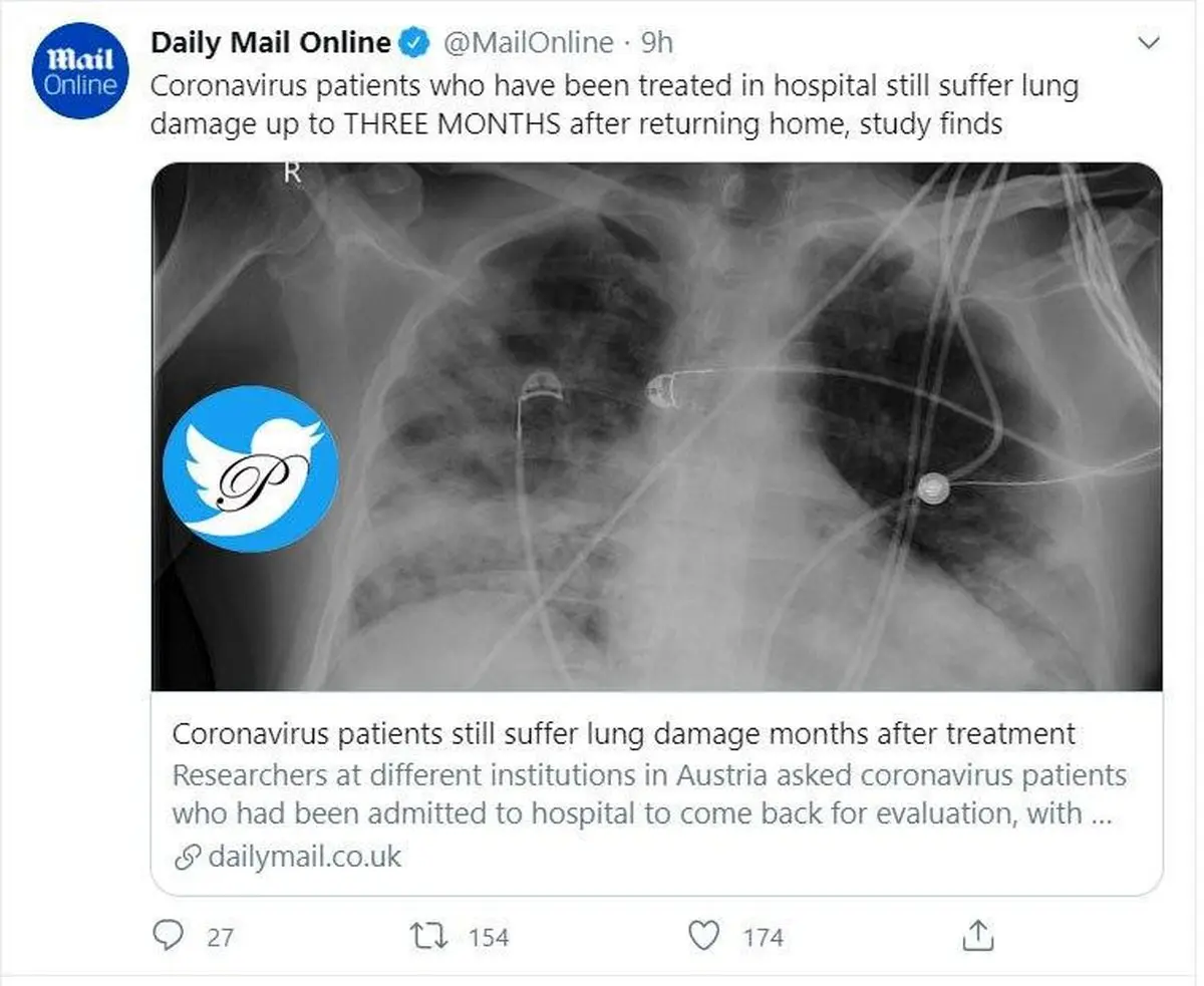 کرونا با این سادگی بی خیال بیماران نمی شود! + توئیتر