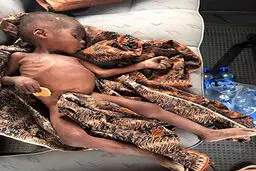 تصاویری تکان دهنده از کودک 2 ساله که 8 ماه کنار خیابان رها شده بود + تصاویر