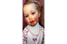 یک بوسه زیبایی این دختر را به باد داد+عکس