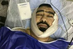 حمله خونین به یک طلبه در شرق تهران/ ضارب: شیطان به من الهام کرد +عکس