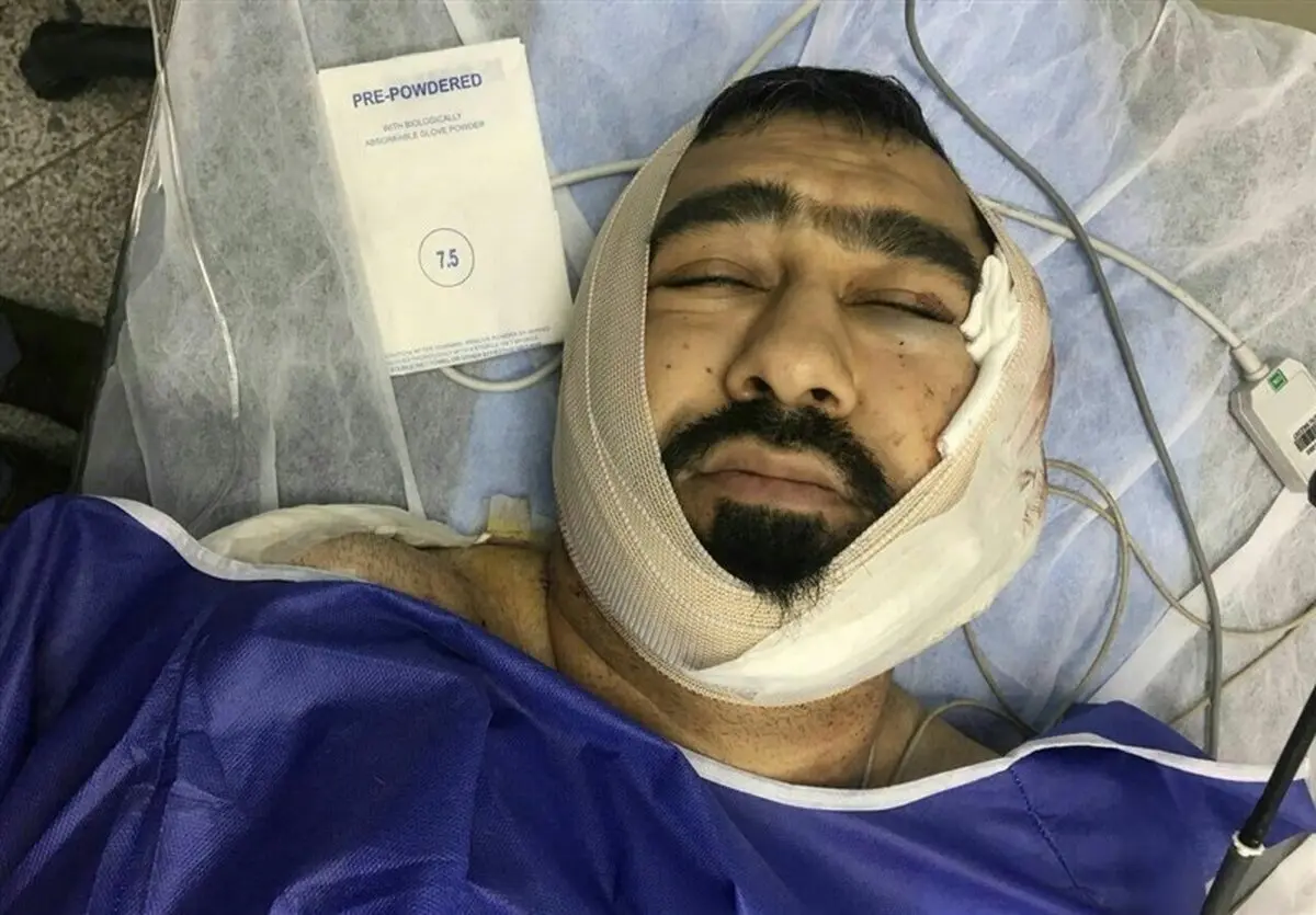حمله خونین به یک طلبه در شرق تهران/ ضارب: شیطان به من الهام کرد +عکس