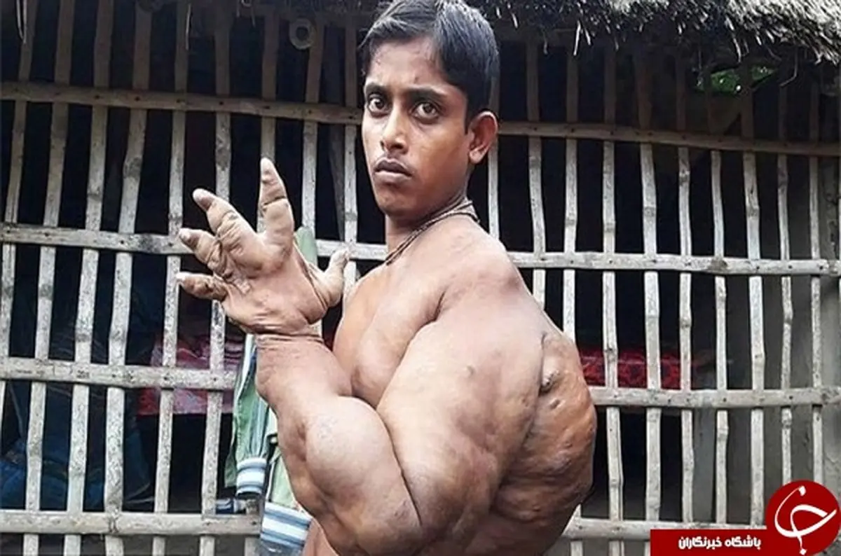 دست اسرارآمیز نوجوان بنگلادشی+تصاویر