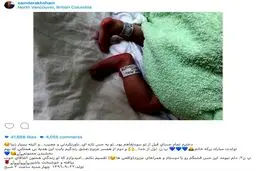 دختر سام درخشانى به دنیا آمد/عکس