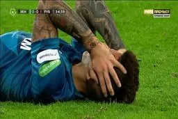 ضربه مغزی هم‌پستی سردار آزمون + عکس