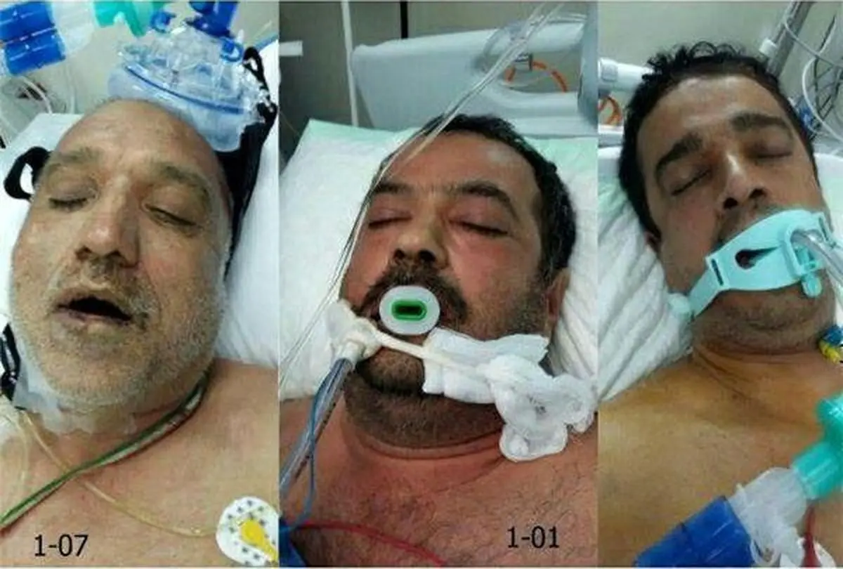 این زائران ایرانی مجهول الهویه و مجروح شده در فاجعه منا را شناسایی کنید/ عکس