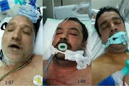 این زائران ایرانی مجهول الهویه و مجروح شده در فاجعه منا را شناسایی کنید/ عکس