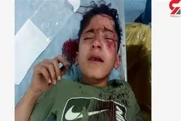 جدیدترین خبر از کولبر 14 ساله که جلوی چشمان مادرش به شدت زخمی شد