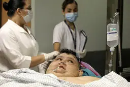 مرد مکزیکی 595 کیلویی در بیمارستان/عکس