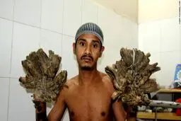 مرد درختی جراحی شد/ عکس