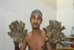 مرد درختی جراحی شد/ عکس