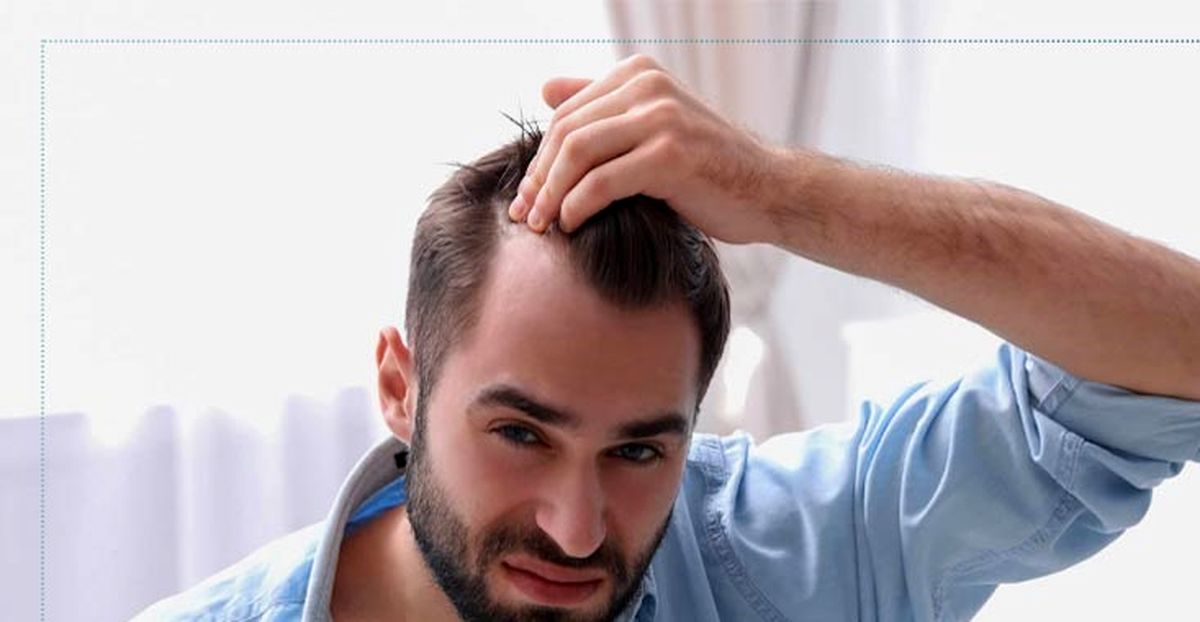 علت ریزش مو در مردان چیست؟ + نحوه درمان