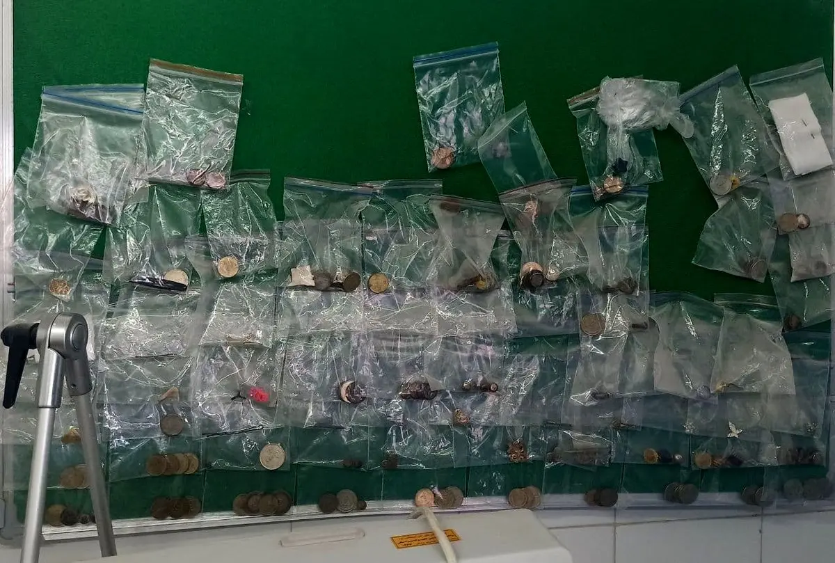 ببینید از تو شکم بچه‌های زیر سه سال چی درآوردن +عکس