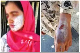 کودک آزاری وحشیانه نامادری سنگدل با اتوی داغ! + عکس