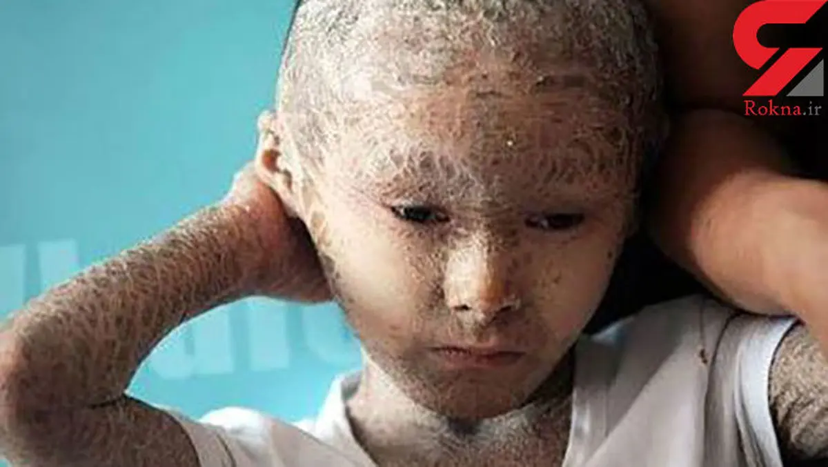 این پسر سالی ۵ بار می‌میرد!+ تصاویر