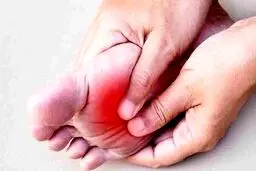 علت داغ شدن کف پا چیست؟