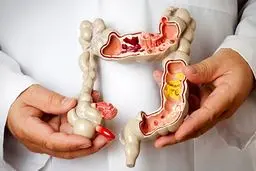 علت بروز یبوست را بشناسید | درمان فوری یبوست با این روش ساده