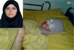 جزای پدری که روی دخترش اسید پاشید+عکس